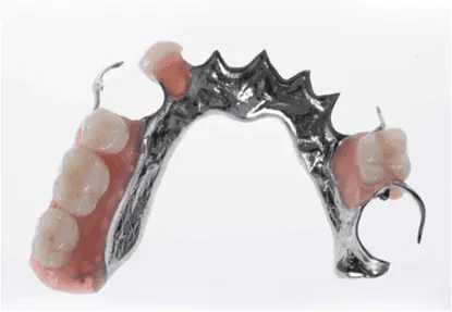 Chrome Dentures