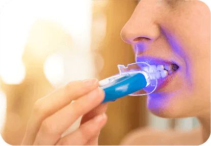 Home Based Bleaching Trays